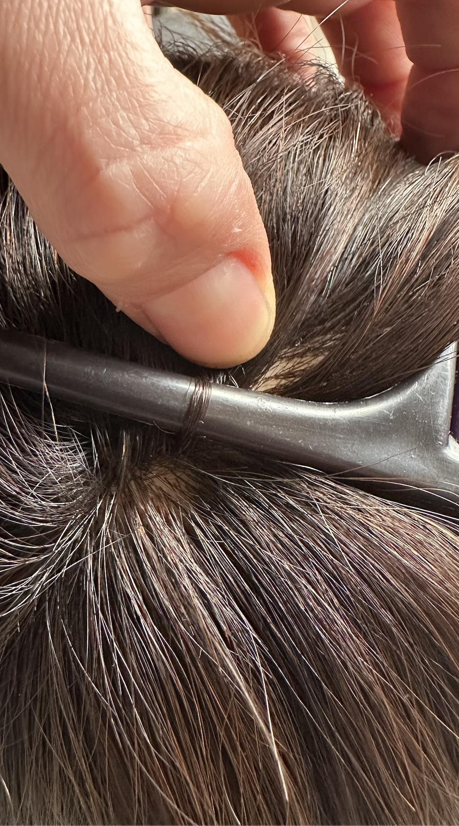 Técnica de fondo negro para distinguir altura 4 y 5